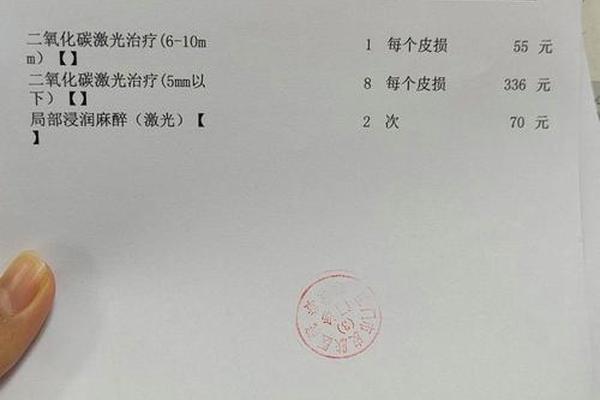 苏州相城医院去痣多少钱-正规医院去痣大概要多少钱
