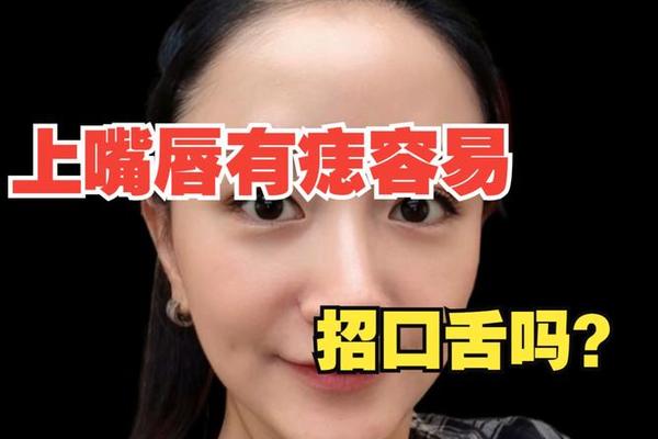口舌 痣相、口舌痣和命运痣的区别