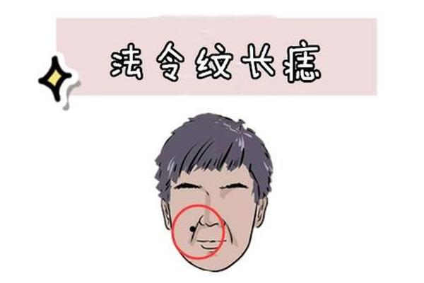 男相法令内纹有痣_法令纹附近的痣好不好 男相法令内纹有痣_法令纹附近的痣好不好
