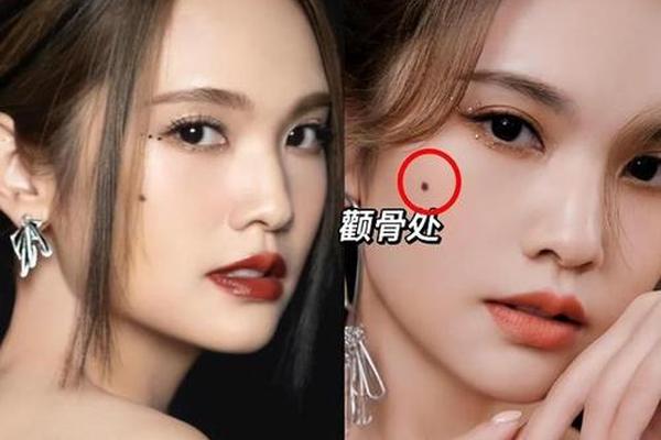 寡妇相颧骨有痣、颧骨突出 面相