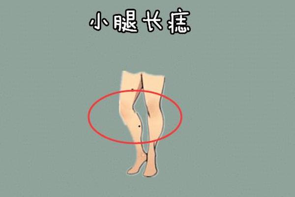 小腿有一个痣痣相(左小腿内侧有痣)