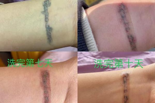 痣相纹身颜色深好吗(洗纹身为什么没变化就是颜色深了)