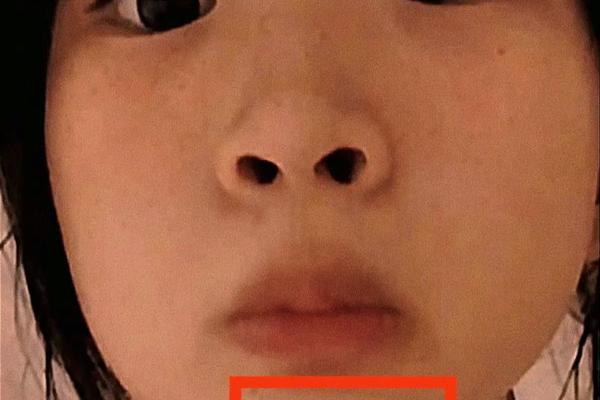 宽之说相下巴有痣_下巴地阁有痣