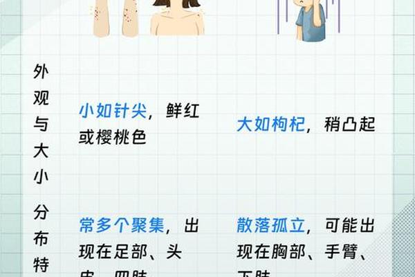 血痣痣相,血痣有什么寓意 血痣痣相,血痣有什么寓意