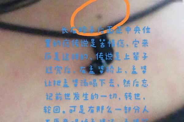 脖子后面有痣相解相_后脖子有痣图解 看相