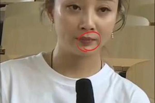 女人右嘴角有痣相-嘴角长痣的女人面相