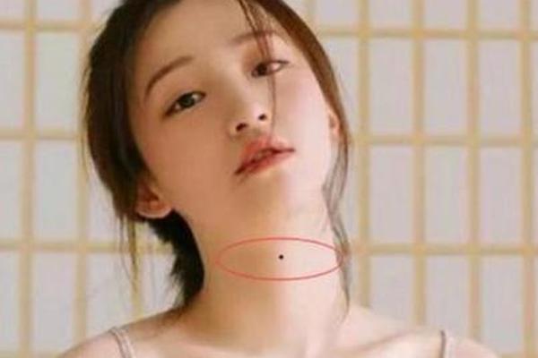 痣相脖子_男人脖子痣左贵右富图