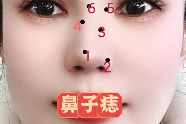 女性鼻梁痣相-女人鼻子旁痣相 女性鼻梁痣相-女人鼻子旁痣相