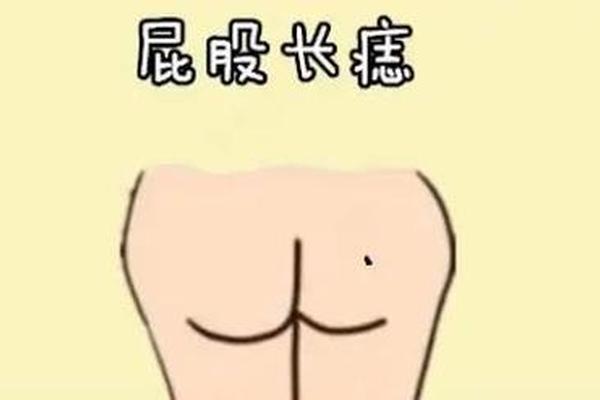 体相屁股有痣帝王相-屁股有痣图解