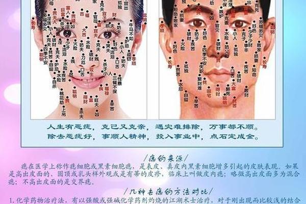 痣相大全图文素材;男人身上痣相大全图解