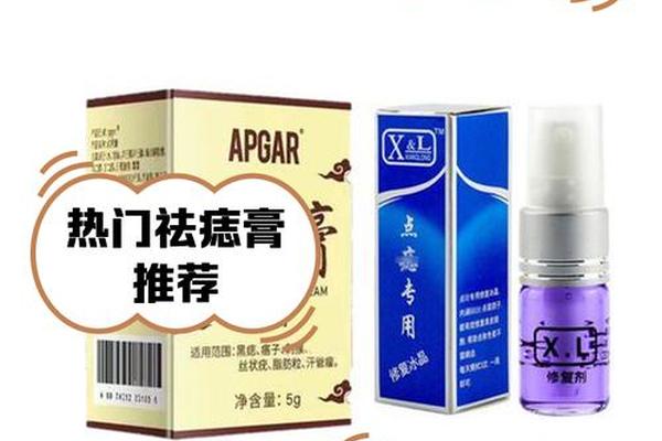北相镇祛痣 祛痣小妙招