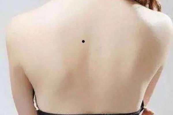 身体痣相女(背后痣相图解大全女)