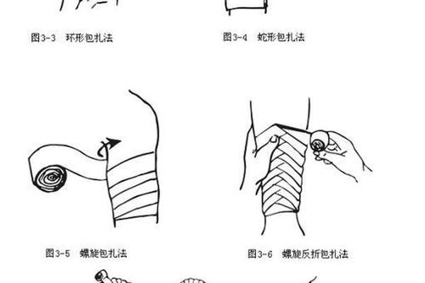 八字包扎法