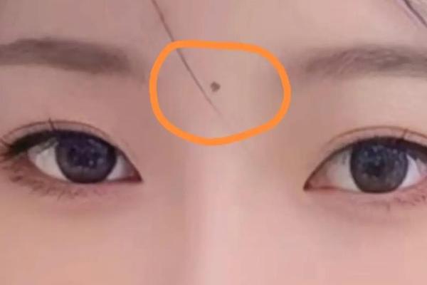 眉间有颗痣相-两眉间长出一颗痣