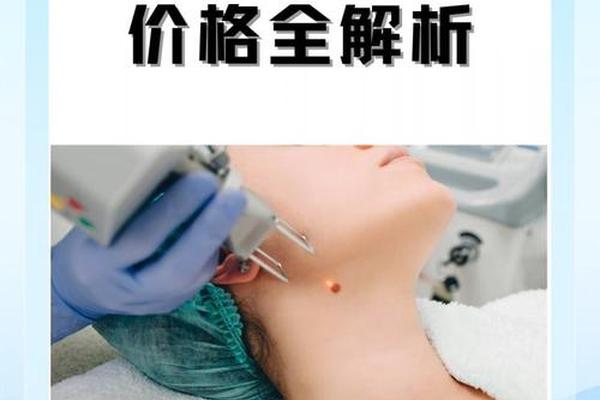 苏州相城激光点痣、苏州哪里点痣比较好