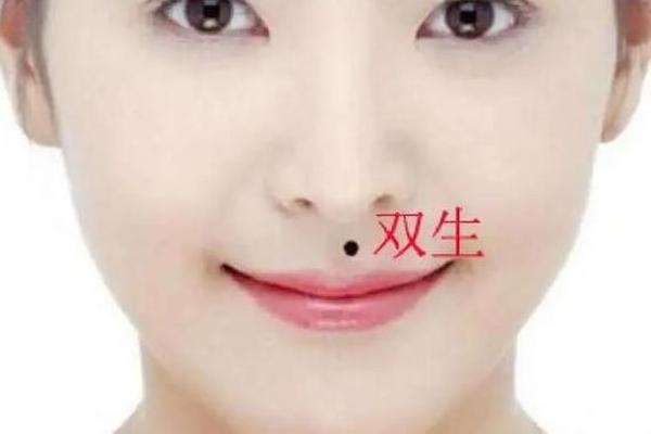 女生痣相双生是什么意思、双生痣代表什么