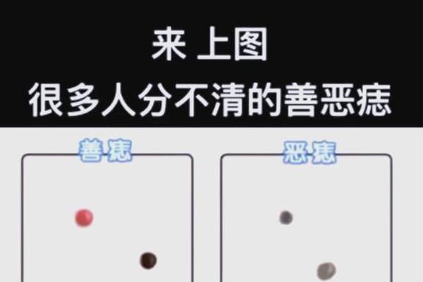 印在痣相上_吉痣与恶痣的区别