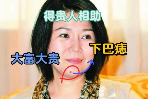 宽之说相下巴有痣_下巴地阁有痣