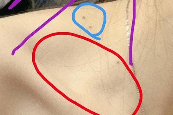 女的锁骨痣相大全详解,锁骨的痣图解女性
