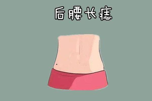 女人后腰痣相最准图(后腰部有痣的女人) 女人后腰痣相最准图(后腰部有痣的女人)