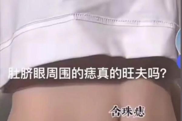 肚脐眼旁有痣相微博(肚脐上痣的位置与命运)