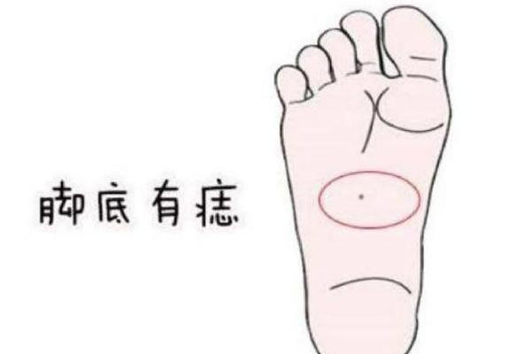 脚侧的痣相(脚侧有痣图解)