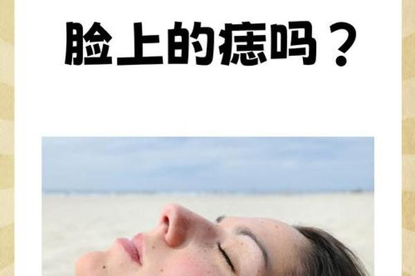 点痣能破痣相吗(点痣能点干净吗)