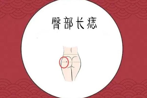 有福报的痣相-屁股痣相图解10大福痣
