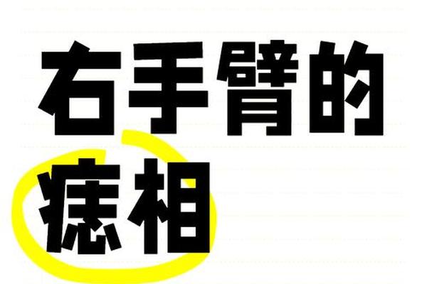 男女手臂上的痣相解说-胳膊有痣代表什么图解 男女手臂上的痣相解说-胳膊有痣代表什么图解