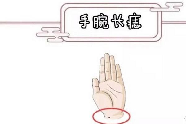 手腕痣相高清图(男面部痣相解析图)