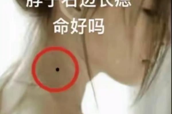痣相女人脖子刹痣相图解(女人左脖子上有痣图解)