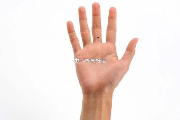 手指上的痣相代表什么、手指上长了一个痣