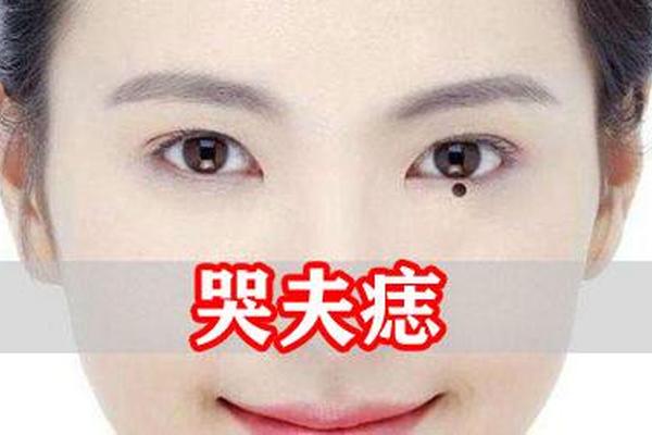 痣相女人脸部流泪、流泪痣的女人的命