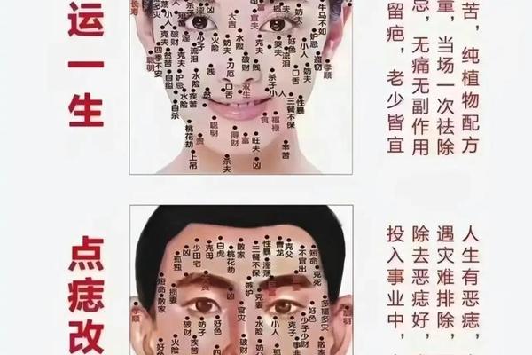 点痣相师烂尾-点痣需要看面相吗 点痣相师烂尾-点痣需要看面相吗