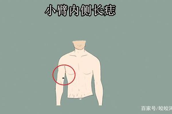 两肘内痣相-手肘内侧长痣