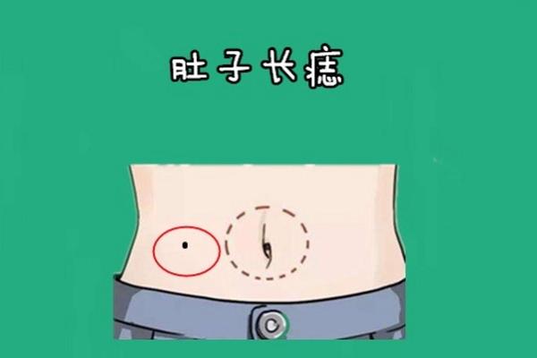 肚子附近的痣痣相;肚子长痣代表什么图解 肚子附近的痣痣相;肚子长痣代表什么图解