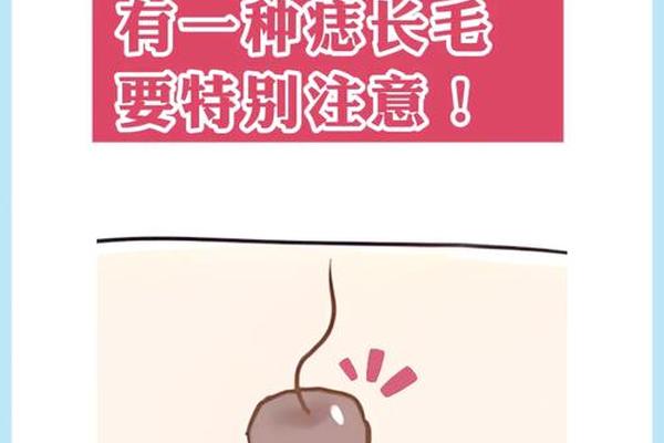 痣相长毛有讲究吗—痣长毛了是好还是不好