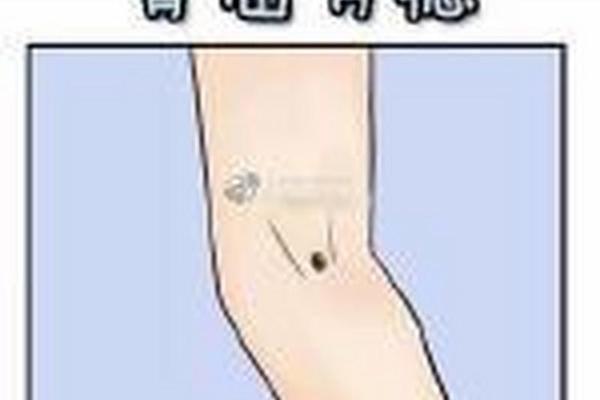 痣相胳膊窝有痣代表什么;腋窝处有痣好不好