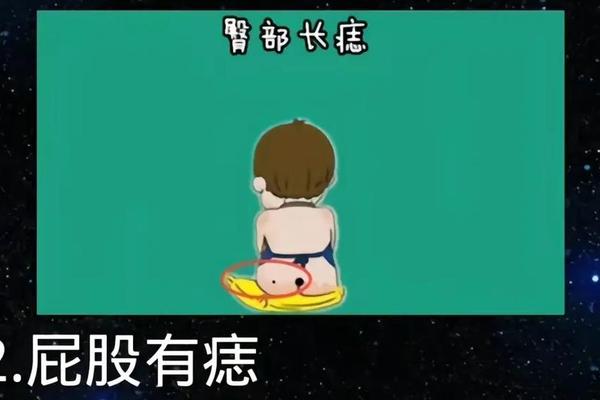 相痣屁权(长在屁股缝里的痣好吗)