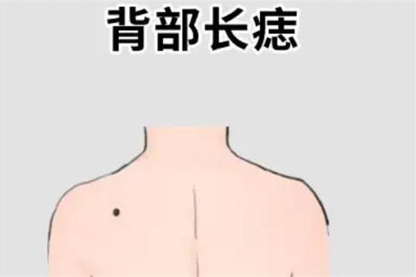 背后痣相 男人后背痣相最准图 背后痣相 男人后背痣相最准图