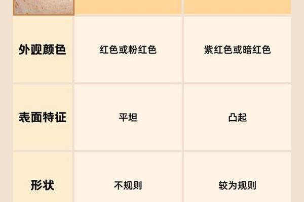 长红痣是福相还是祸相呢-身上长红痣是好还是坏