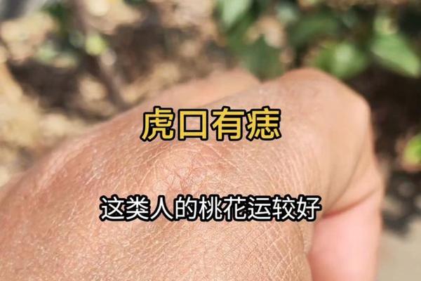 虎口有痣痣相、左手虎口长了一颗痣寓意 虎口有痣痣相、左手虎口长了一颗痣寓意