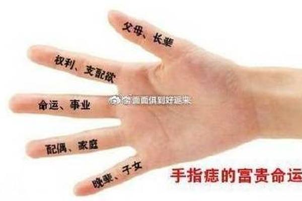 右手大拇指痣相 手掌痣相图解