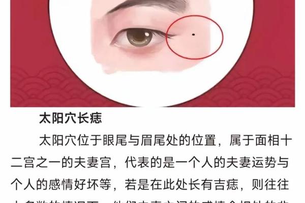 痣相炮盾是什么-痣是平的还是凸起的好