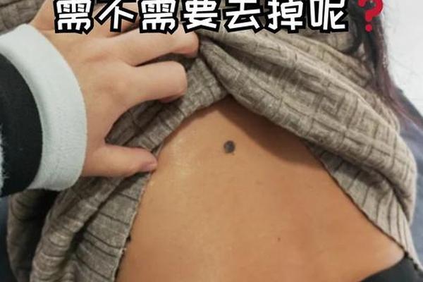 背部痣相解读,肚子痣相图解大全
