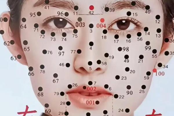 女人发际线痣相最准图、发际线有痣的女人 女人发际线痣相最准图、发际线有痣的女人