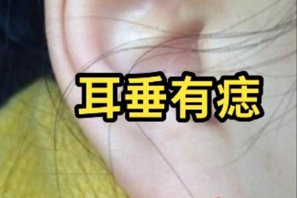 痣相虎耳-耳朵上的痣命相图解