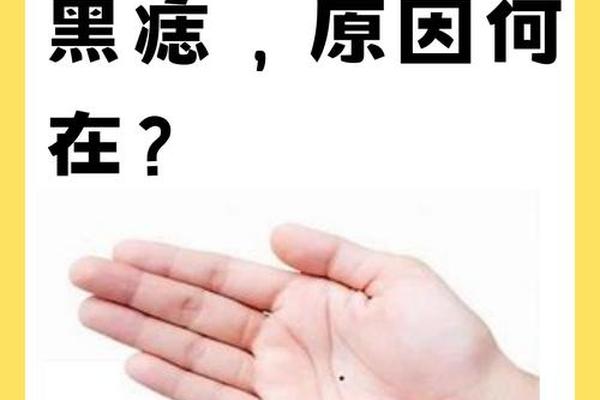 右手手心痣相,右手掌心长了一个痣 右手手心痣相,右手掌心长了一个痣