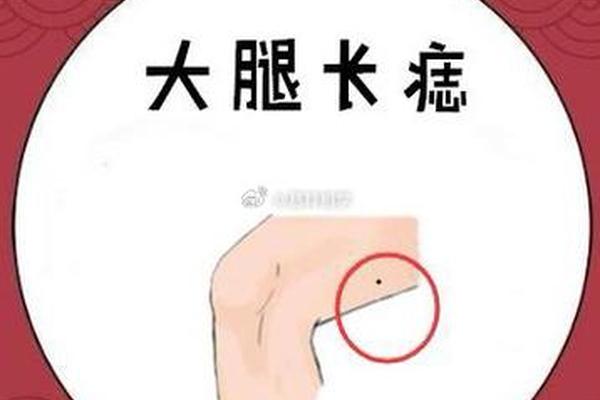 麻衣神相大腿根部有痣—大腿根长痣代表什么