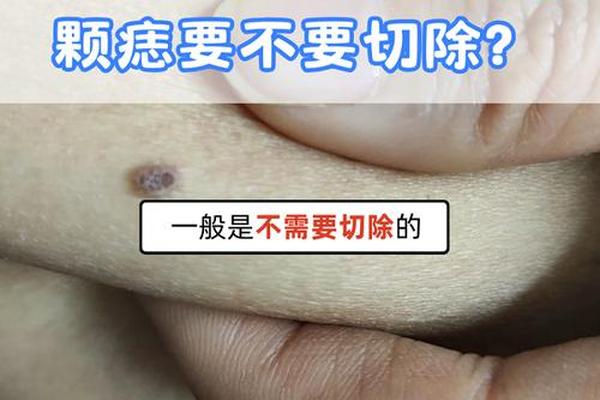 后背左腰痣相—女人左侧腰部痣相图解